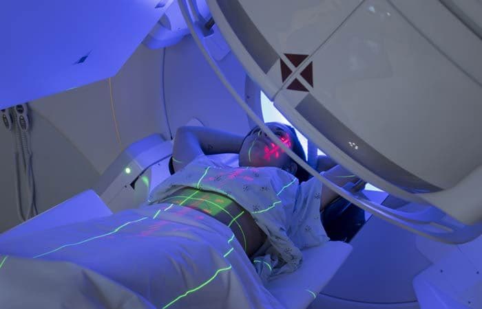 radioterapia