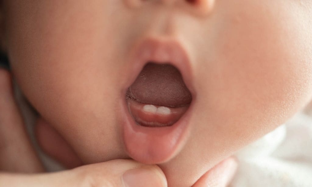 Dientes de leche