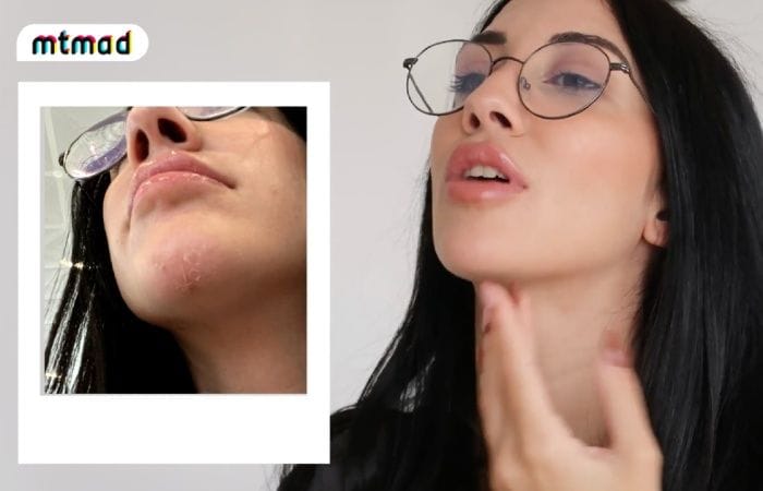Naomi muestra su mentón 