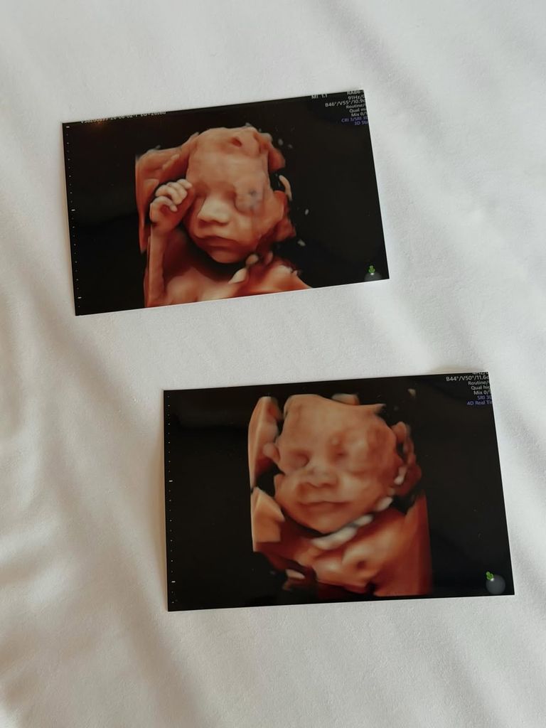 La carita de la pequeña Valentina