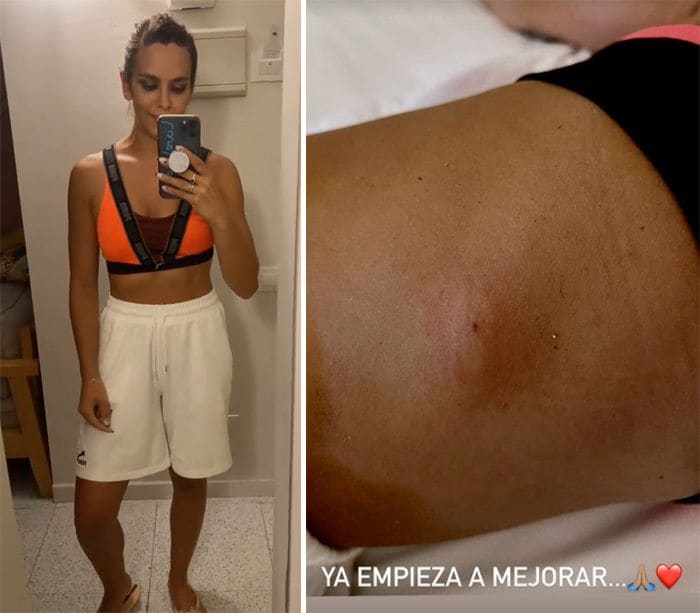 Cristina Pedroche