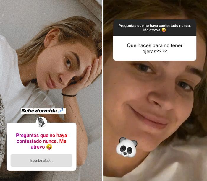 Laura Escanes muestra sus ojeras... ¡sin filtros!