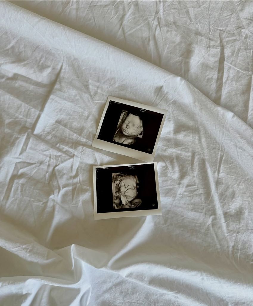 La primera ecografía que Lucía Pombo ha compartido de su hija