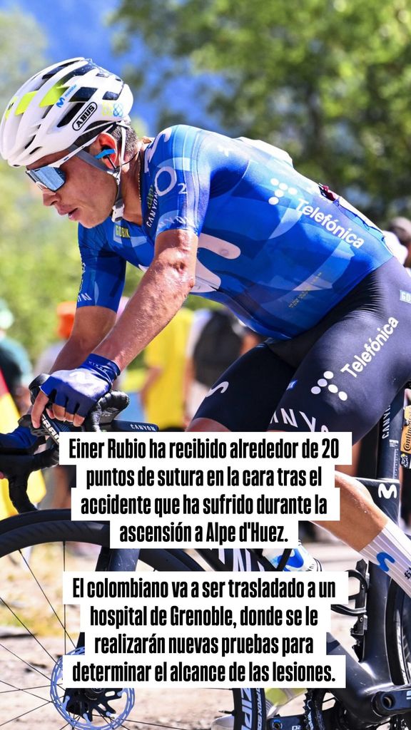 Einer Rubio recibió alrededor de 20 puntos en la cara, tras el accidente sufrió en la ascensión a Alpe d'Huez, informó su equipo. 