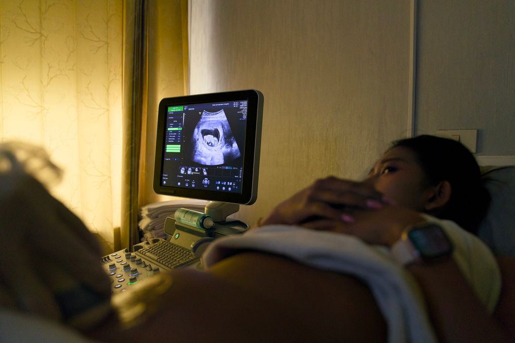 Ecografía de mujer embarazada