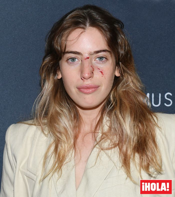 Clara McGregor muestra cómo ha quedado su cara después de ser atacada