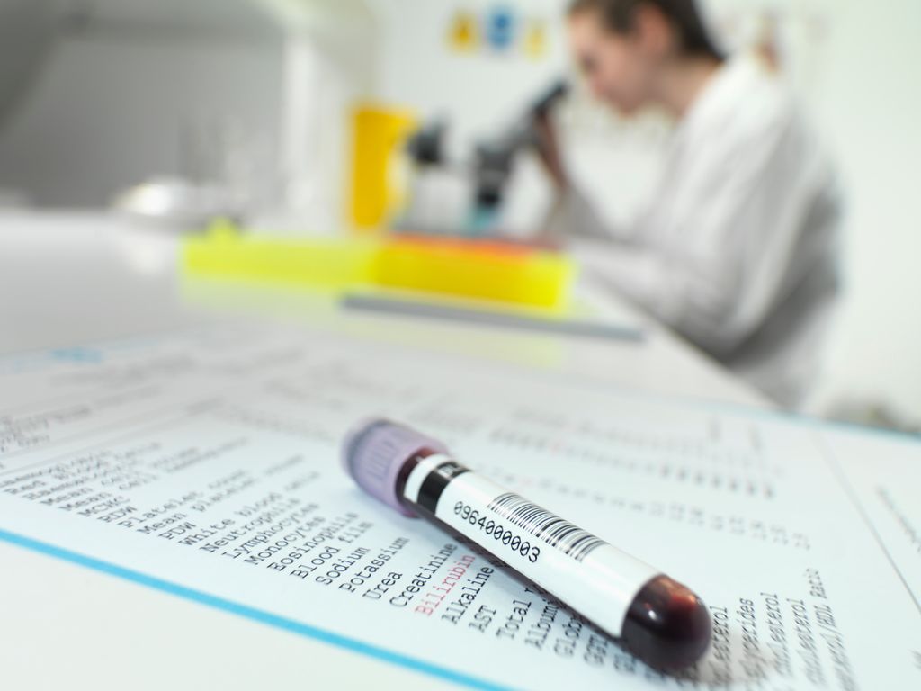 Tubo de analítica de sangre con investigadora al fondo