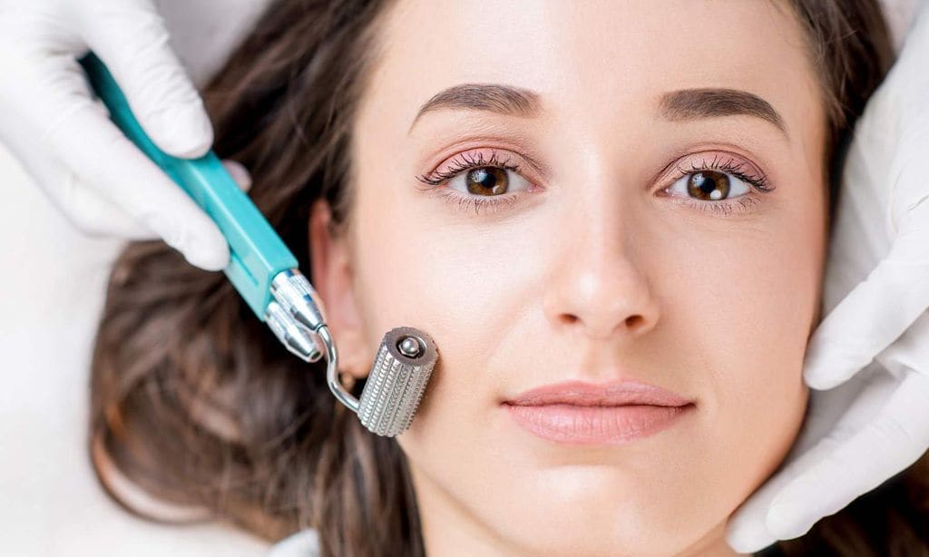 Chica en sesión de Microneedling