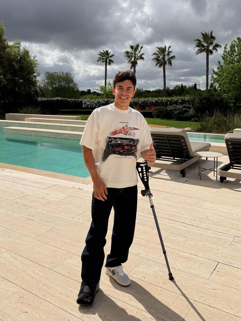 Marc Márquez recibe el alta 24 horas después de su operación y ya descansa en su hogar en Madrid