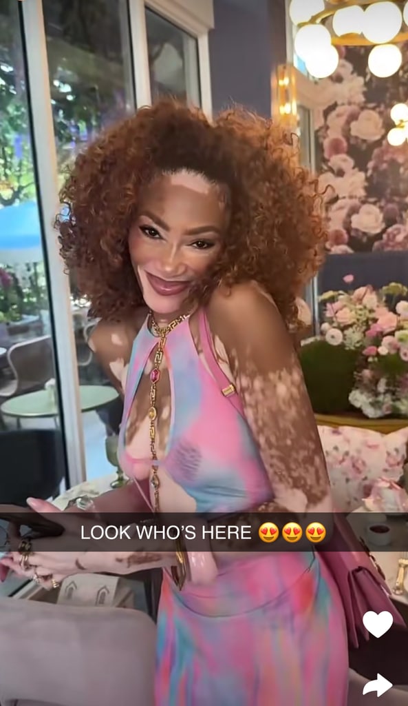 La modelo Winnie Harlow también estuvo presente en el baby shower de Lele Pons.