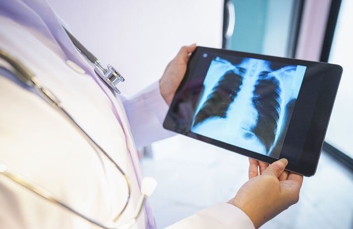 radiografía de pulmón
