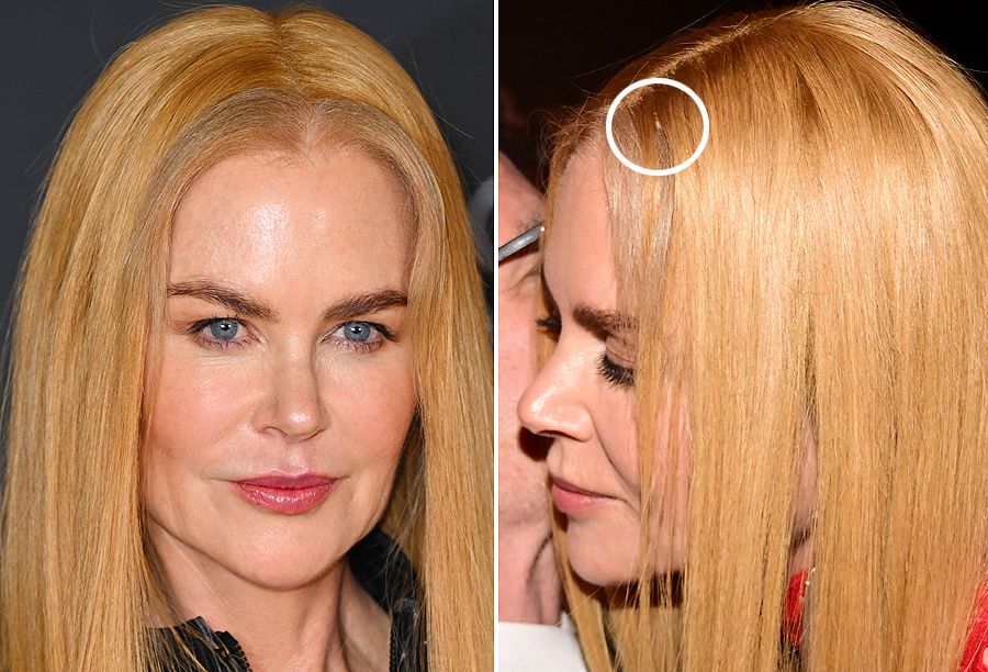 Nicole Kidman