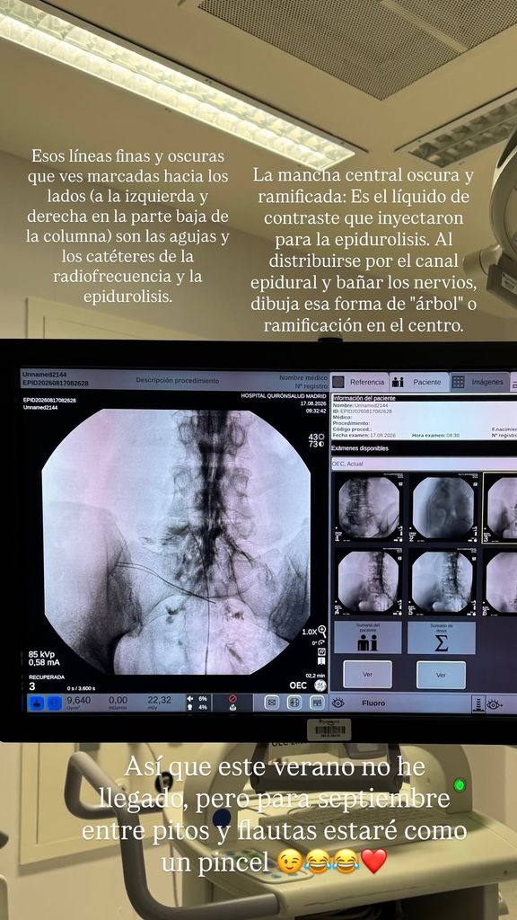 La segunda imagen explicativa que ha publicado Diego Matamoros sobre su intervención