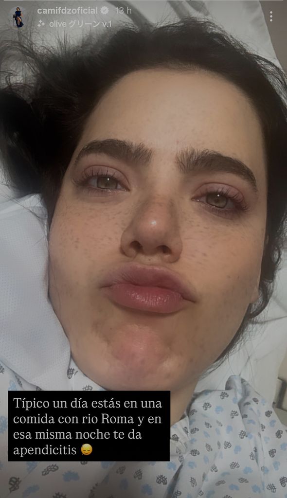 Camila Fernández reveló que había sido hospitalizada por una apendicitis.