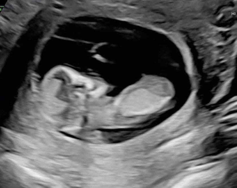 La pareja ha sorprendido a los fanáticos de la serie
