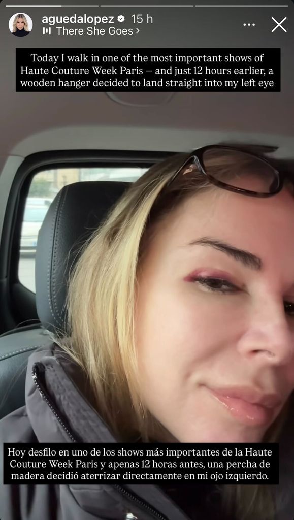 La modelo compartió en sus redes sociales el desafortunado evento que le sucedió poco antes de aparecer en Paris Fashion Week. 