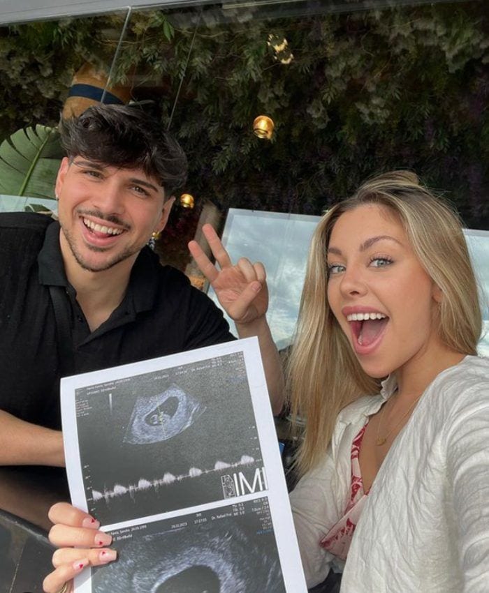 Darío y Sandra muestran la ecografía de su primer hijo 