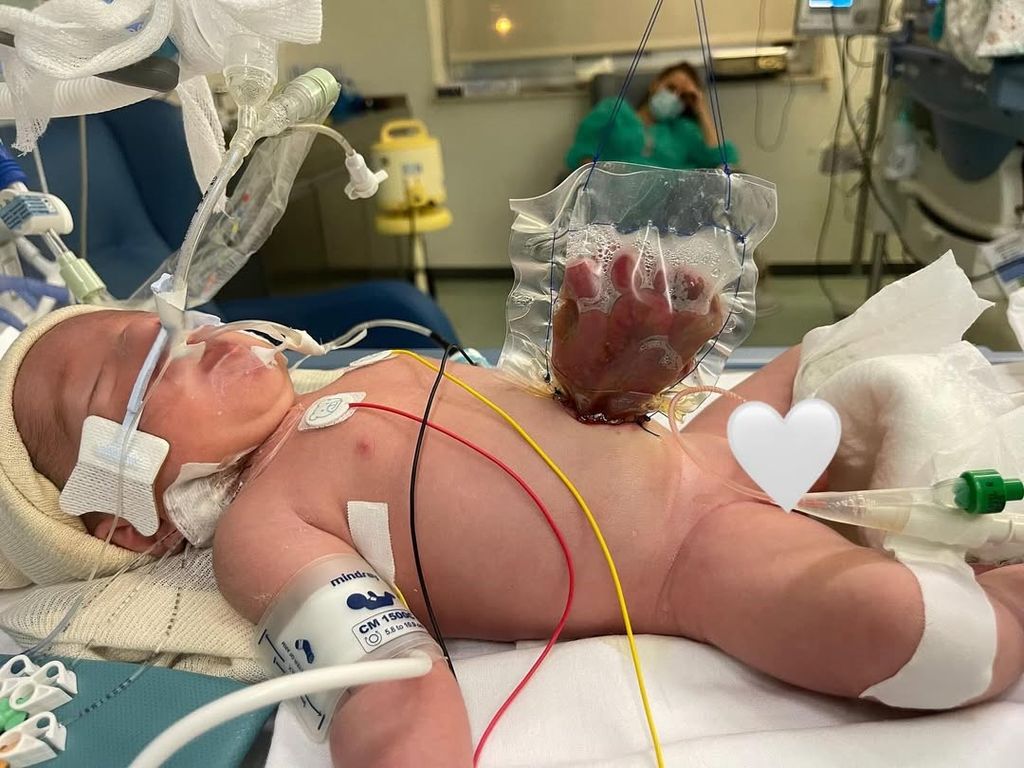 Diego, el hijo mayor de Lucía Villalón, hospitalizado al nacer