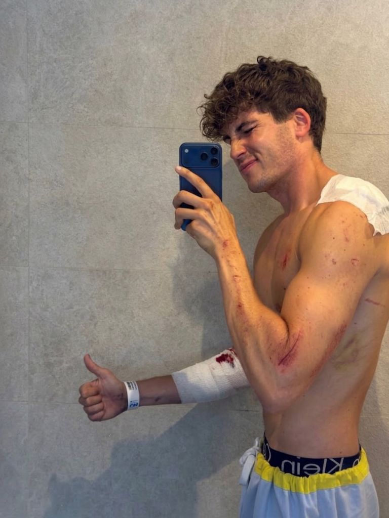 El 'influencer' Javier Gallardo sufre un grave accidente de moto en Madrid