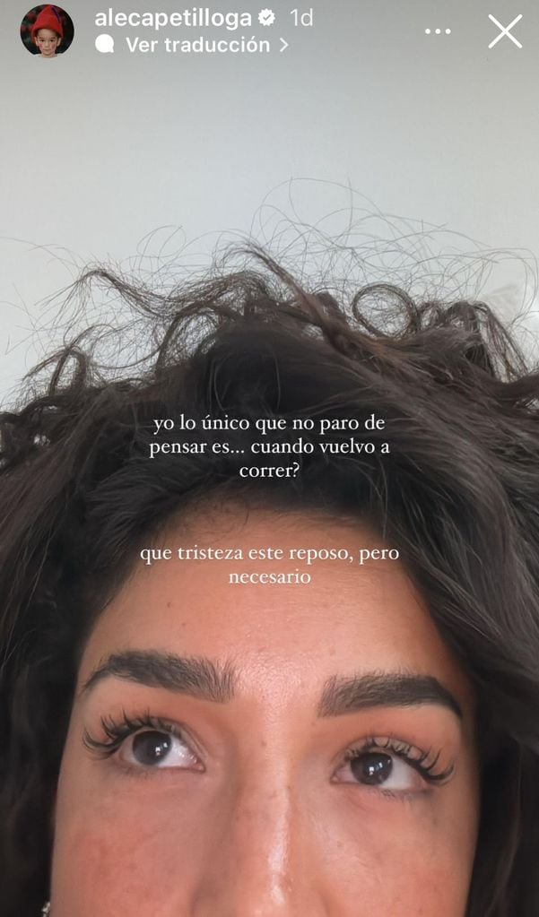 Ale Capetillo tendrá que guardar reposo.