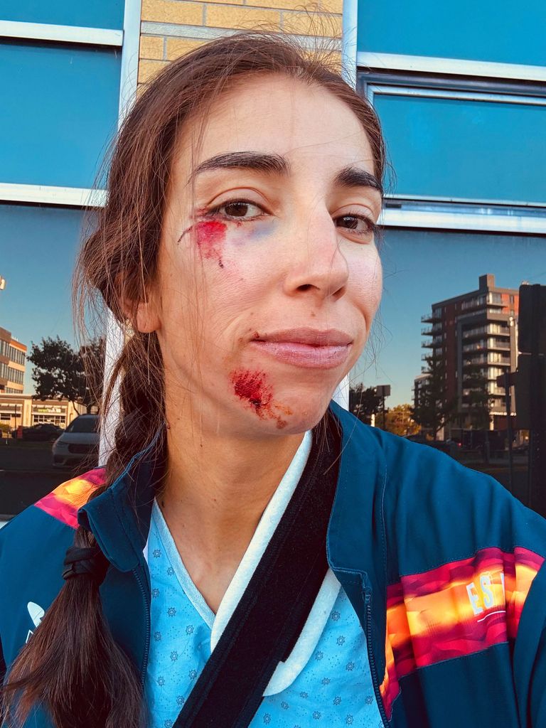 Así salió Sandra del hospital tras su grave accidente