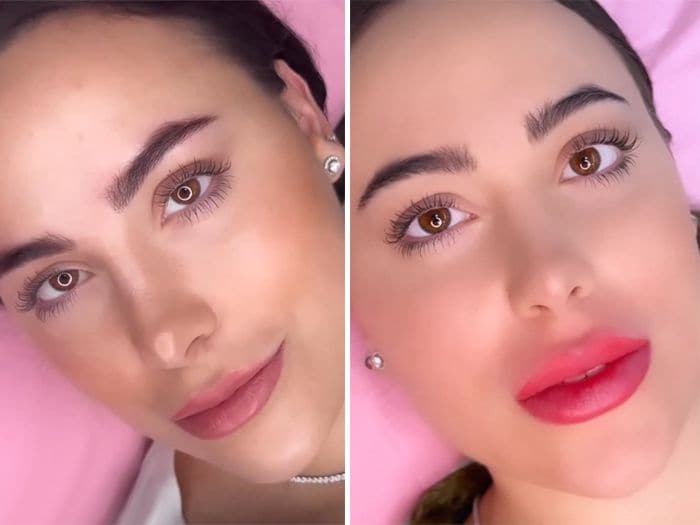 Ivana Rodríguez se hace la micropigmentacion de labios
