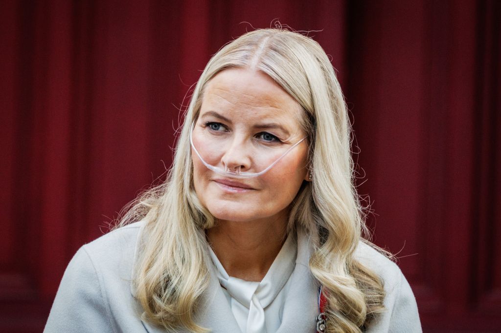 Mette-Marit de Noruega, transplantada de un pulmón