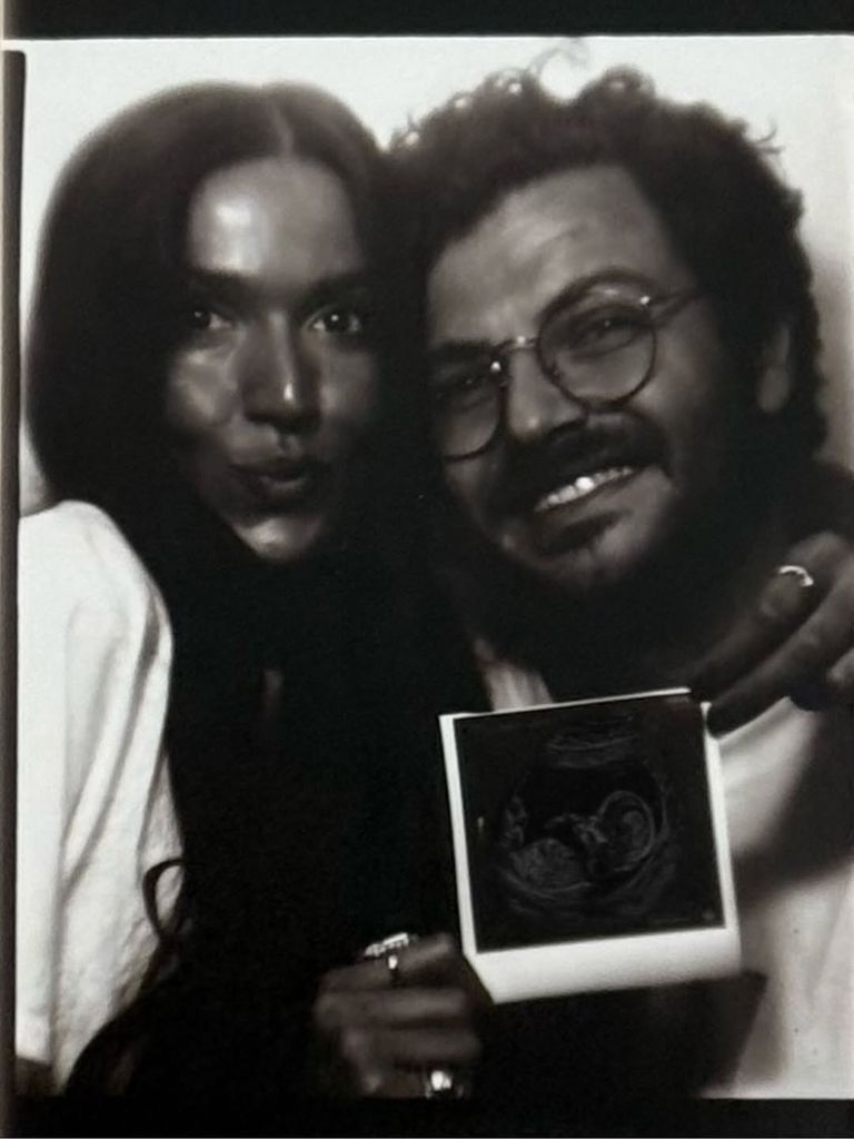 Alejandra Navarro y Carlos Fuente han compartido la noticia mostrando la ecografía del bebé