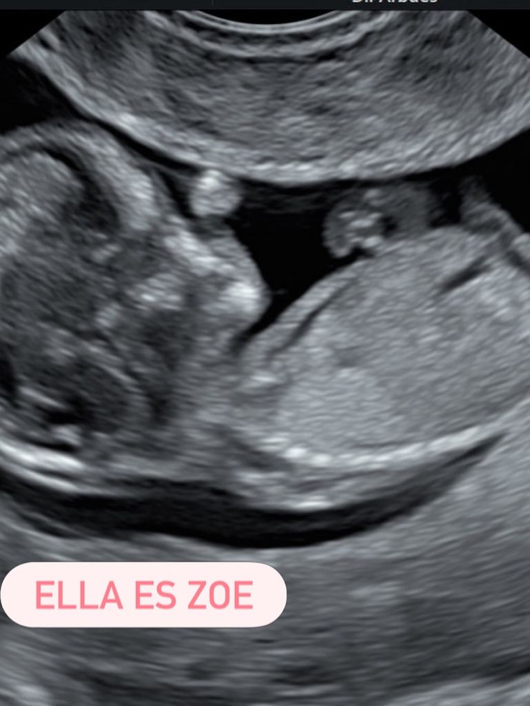 "Ella es Zoe", dijo la azafata de 'La Ruleta de la Suerte'