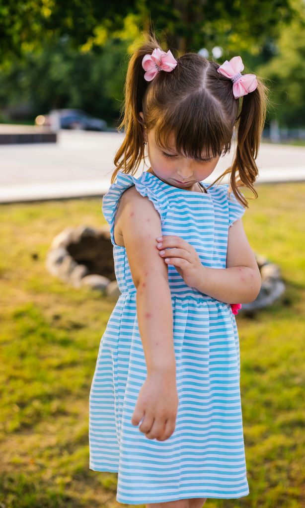 Niña rascandose picadura de insecto en el brazo