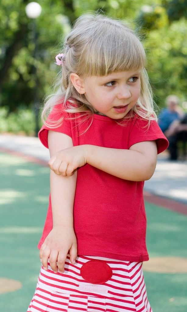 Niña rascándose brazo