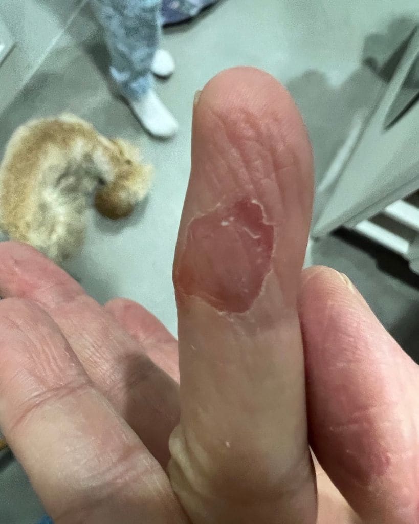 Imagen del problema de salud que sufre en su piel