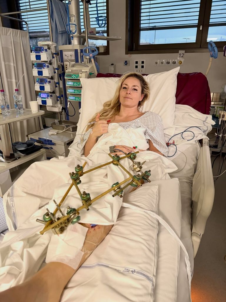 Lindsey Vonn ha mostrado en sus redes sociales cómo está su pierna tras la tercera operación que ha sufrido