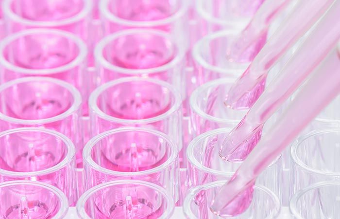 Avances en tratamientos en cáncer de mama