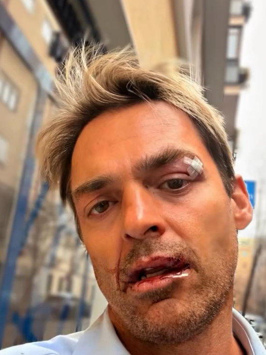 Hugo Castejón en su Instagram