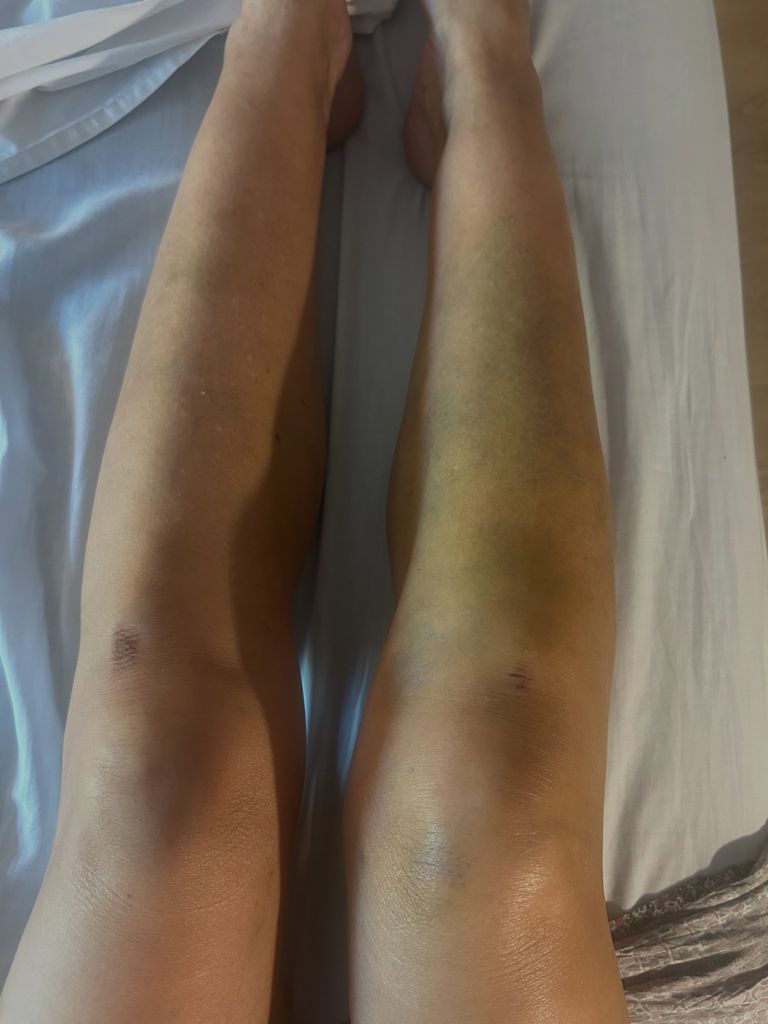 La actriz ha tenido que acudir al hospital y ha salido en silla de ruedas