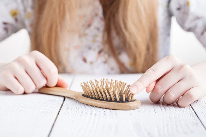 alopecia mujer caída de pelo