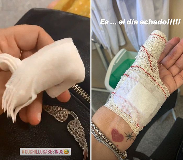 Toñi Moreno y el pequeño accidente que le ha llevado a urgencias