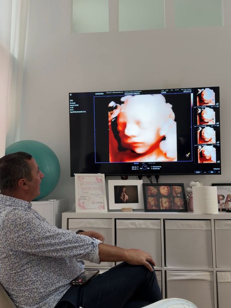 Claudia en consulta viendo por primera vez la cara de su bebé