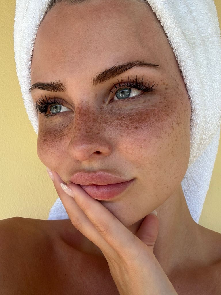 Amanda Strand con toalla en la cabeza y pecas en la cara