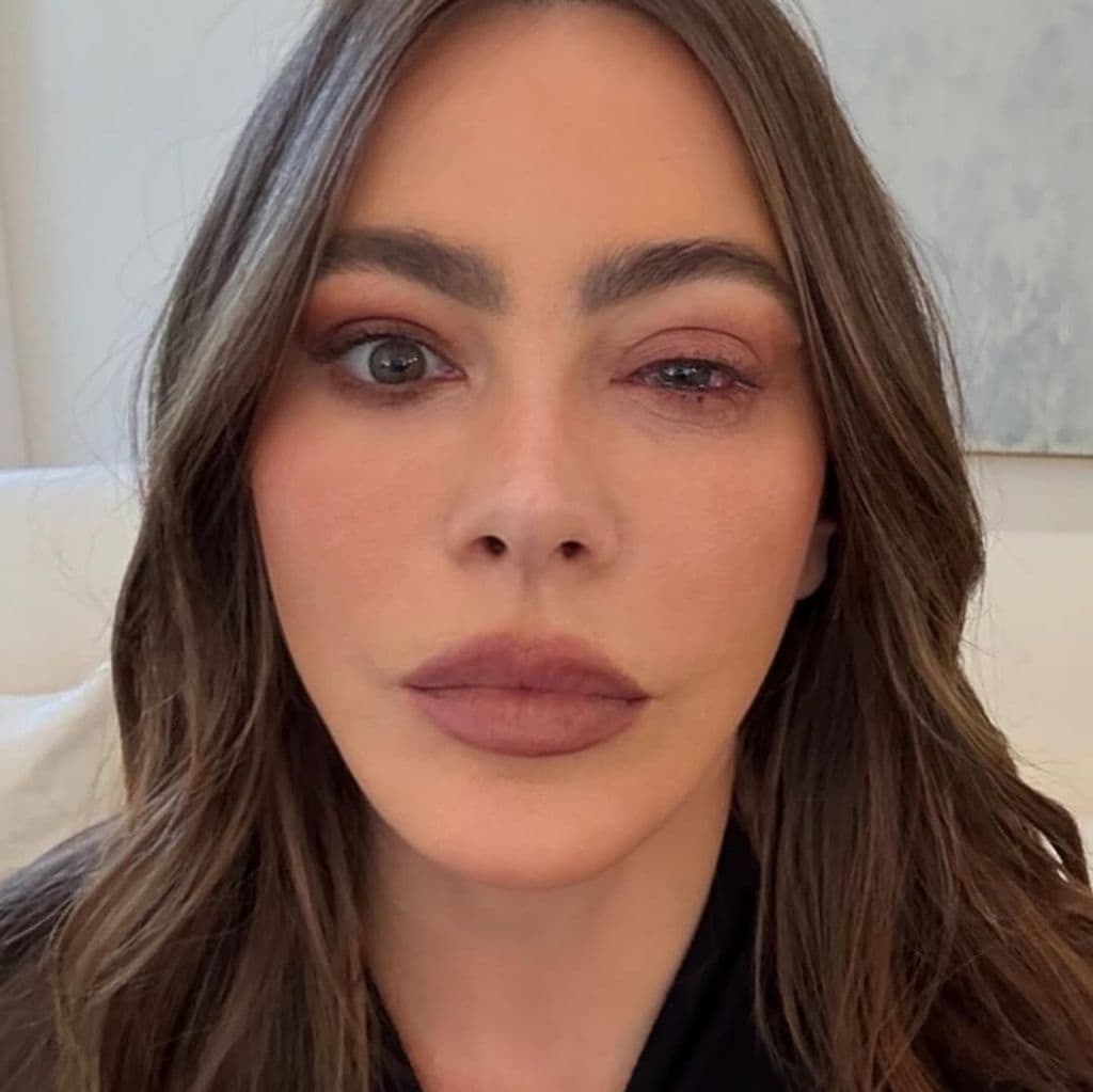 Sofia Vergara no pudo ir a los premios Emmy 2025 por una alergia en el ojo