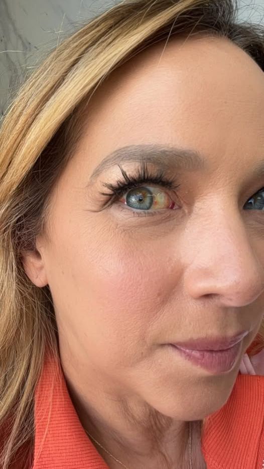 Adamari López comparte cómo ha mejorado su ojo