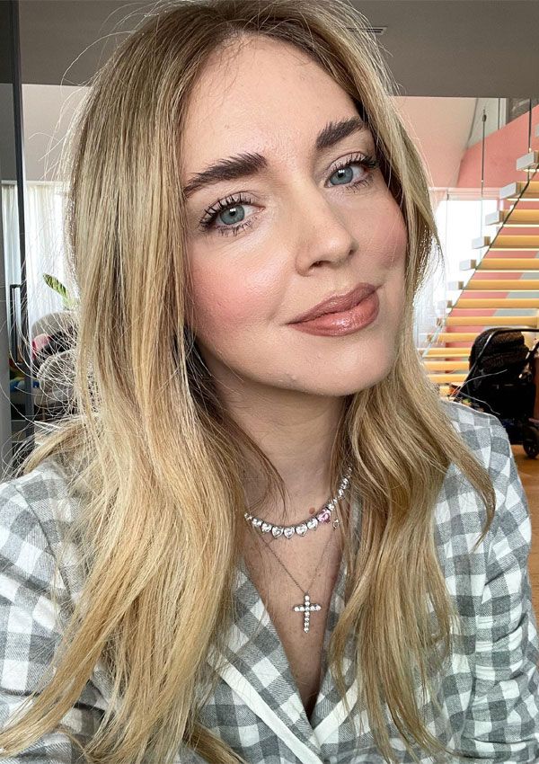 Chiara Ferragni se sincera sobre su acné en un momento difícil para familia