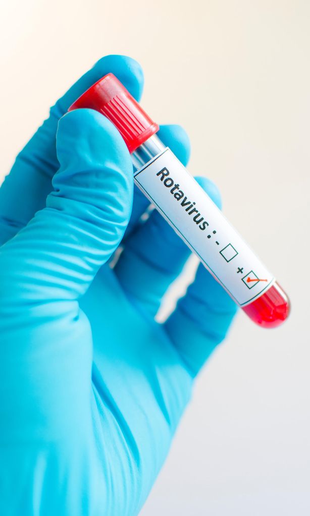 Virus del rotavirus