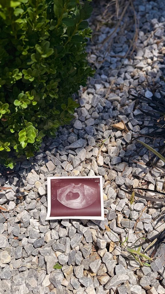 La ecografía del bebé que esperan Patricia Steisy y Pablo Pisa