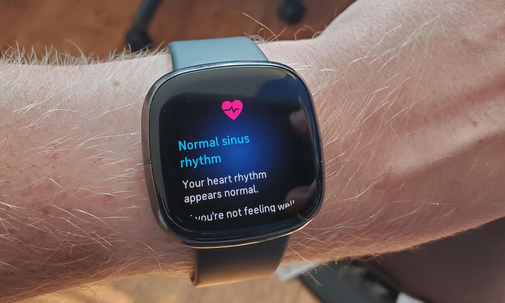 Heart rate
