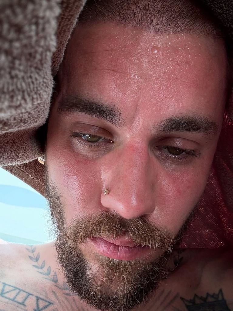 Las 'selfies' que ha subido Justin Bieber a sus redes sociales: "Detox"