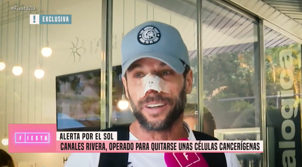 El extorero se ha operado la nariz como consecuencia de la exposición al sol