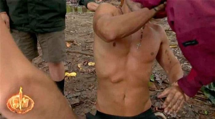 Hugo Sierra bulto abdomen