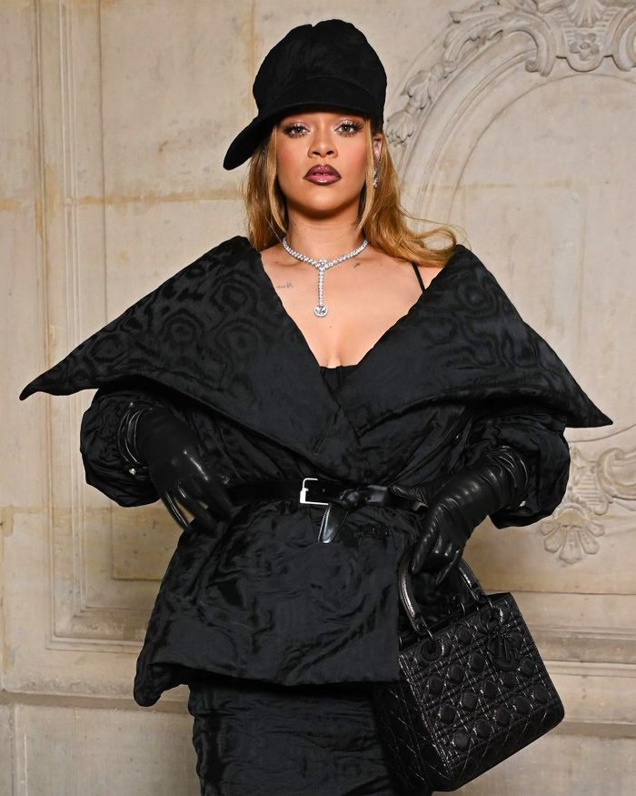 La tendencia de labios que arrasa entre las celebrities